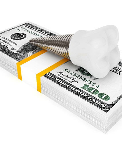 Dental implants with money